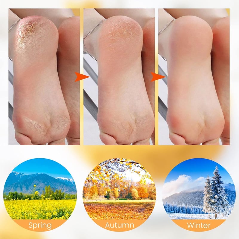 SoftStep™ Silicone Spa Socks | BOGO Offer